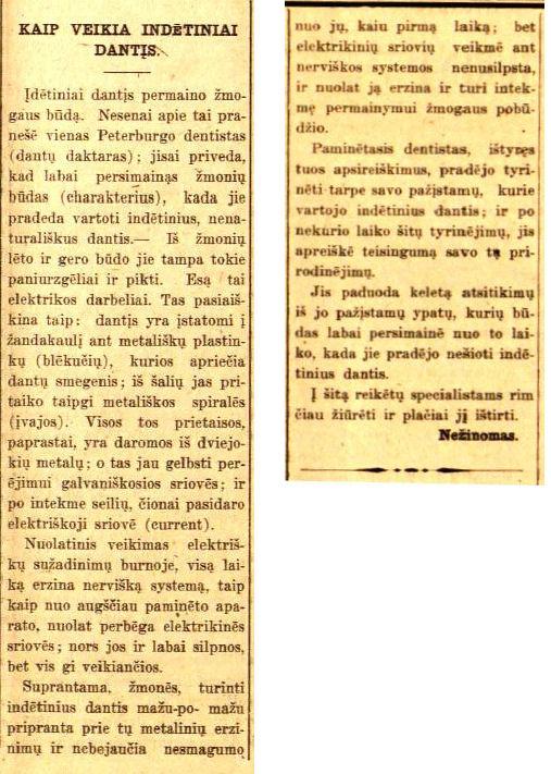 Ralys, Jeronimas. Kaip veikia indėtiniai dantys